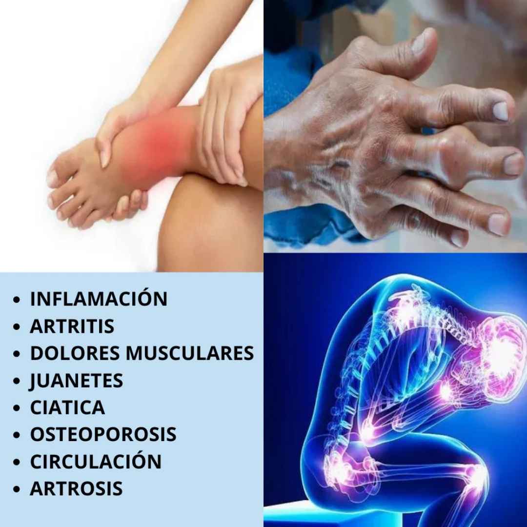 PerfectX™ – La crema natural que devuelve la movilidad a tus articulaciones en 15 minutos