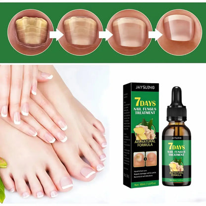 FungiShield Pro™ – Las gotas preventivas que crean una barrera natural invisible contra hongos antes de que aparezcan