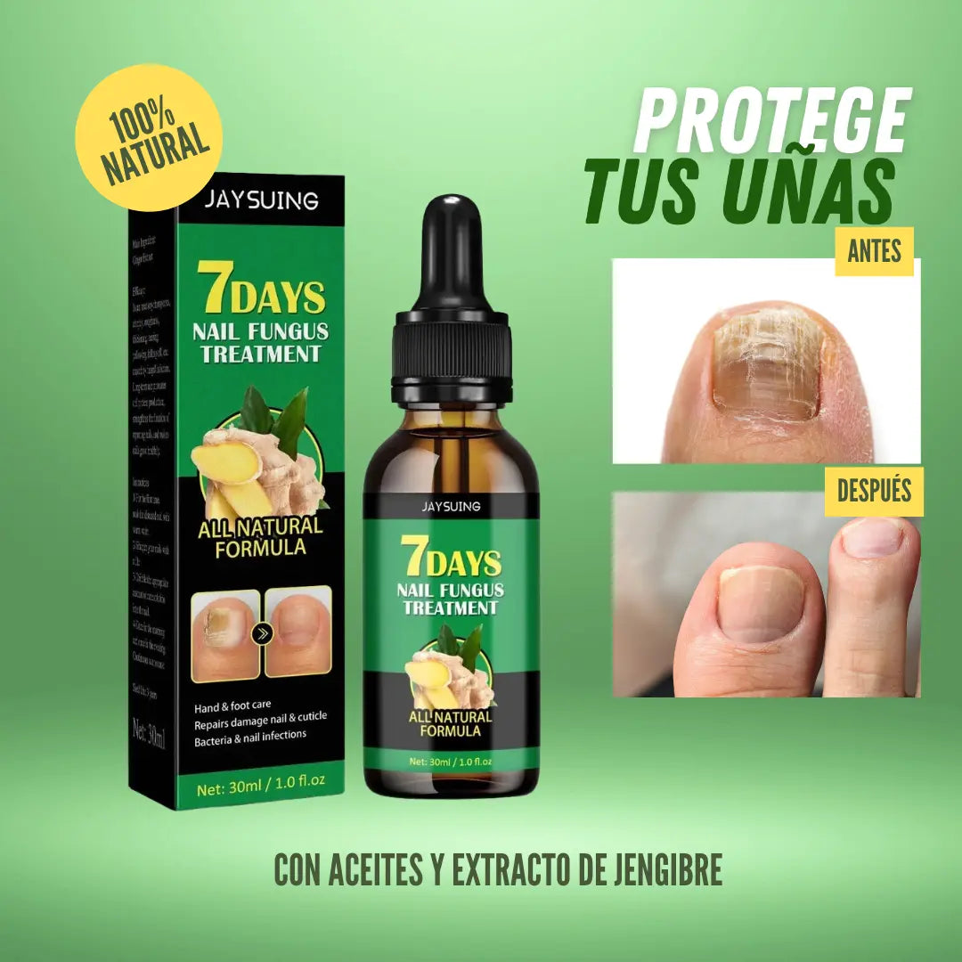 FungiShield Pro™ – Las gotas preventivas que crean una barrera natural invisible contra hongos antes de que aparezcan