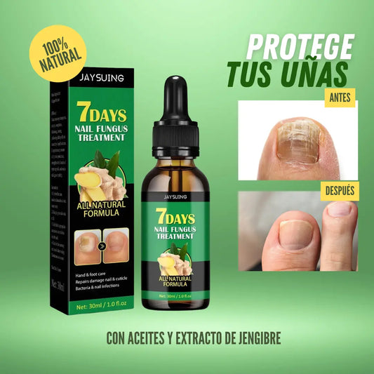FungiShield Pro™ – Las gotas preventivas que crean una barrera natural invisible contra hongos antes de que aparezcan